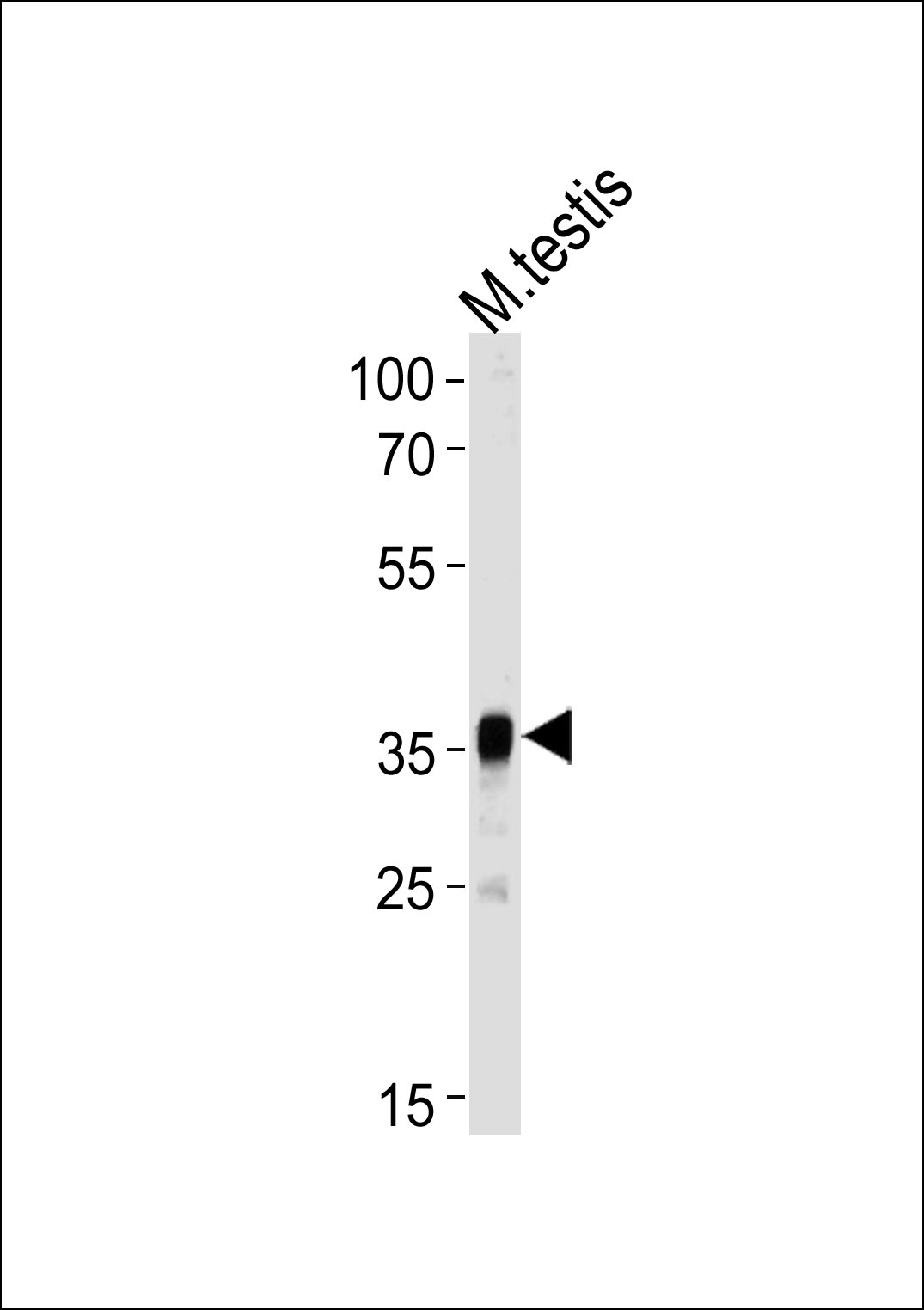Mouse Pbk Antibody (N-term) [APR04430G]