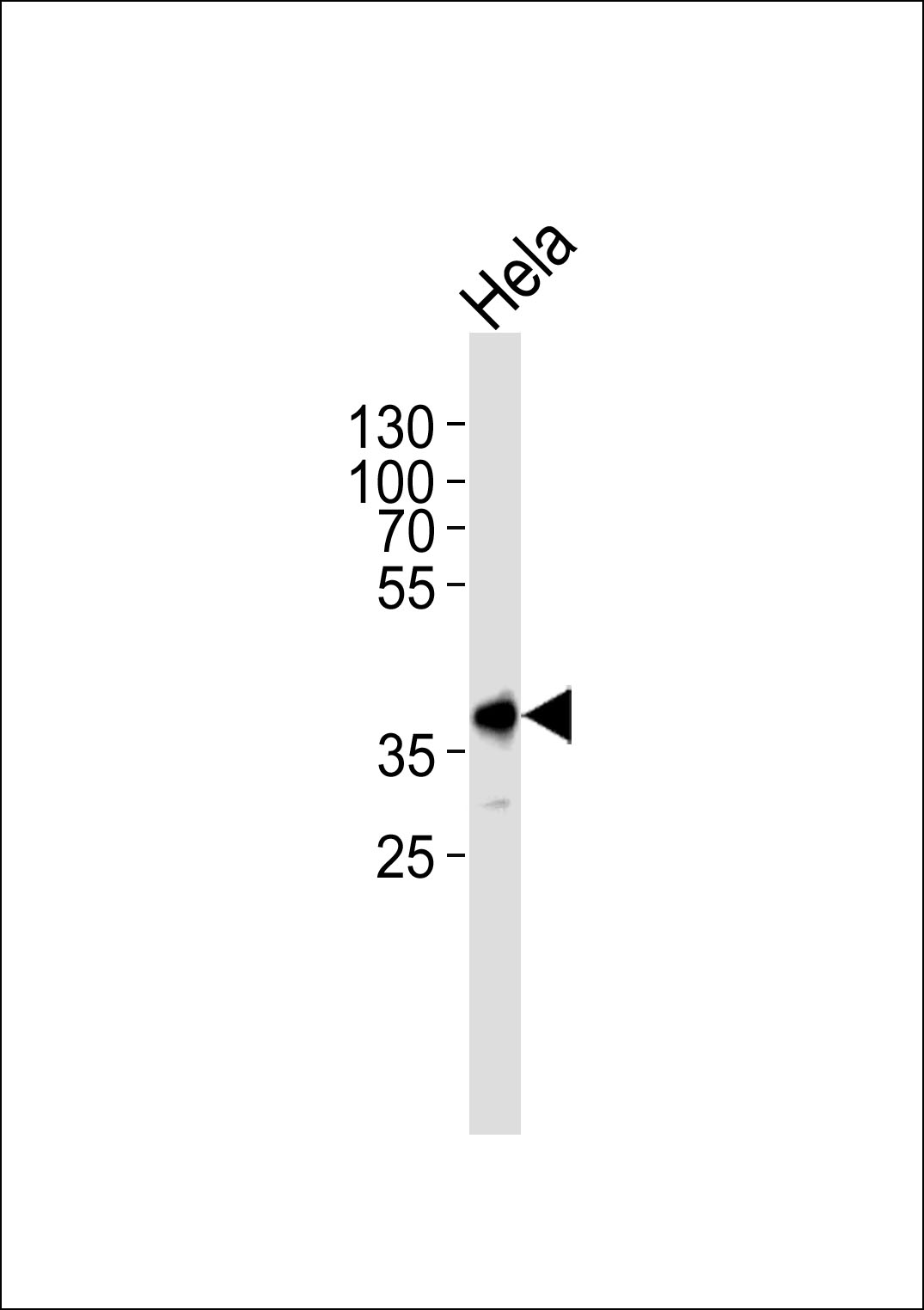 Mouse Pbk Antibody (N-term) [APR04430G]