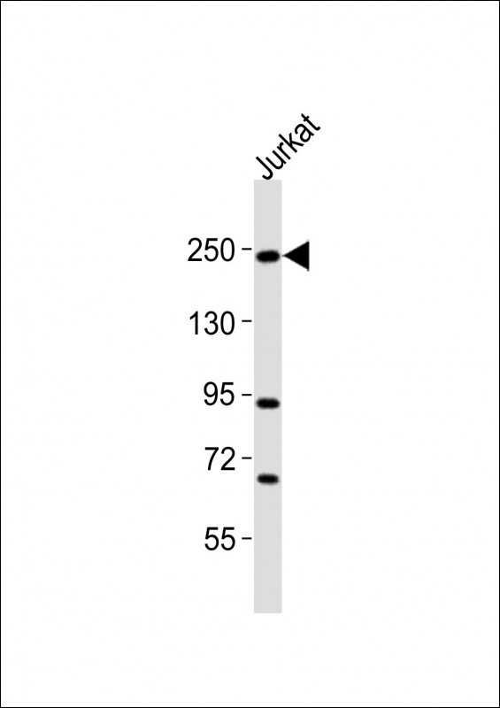 DOCK2 Antibody (C-term) [APR15796G]