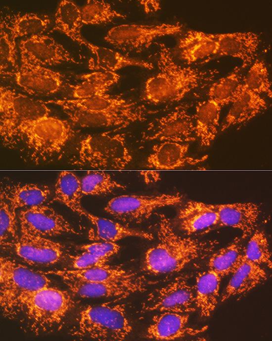 ACSL1 Rabbit pAb (APR22848N)