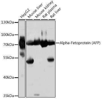 Alpha-Fetoprotein (AFP) Rabbit pAb (APR23338N)