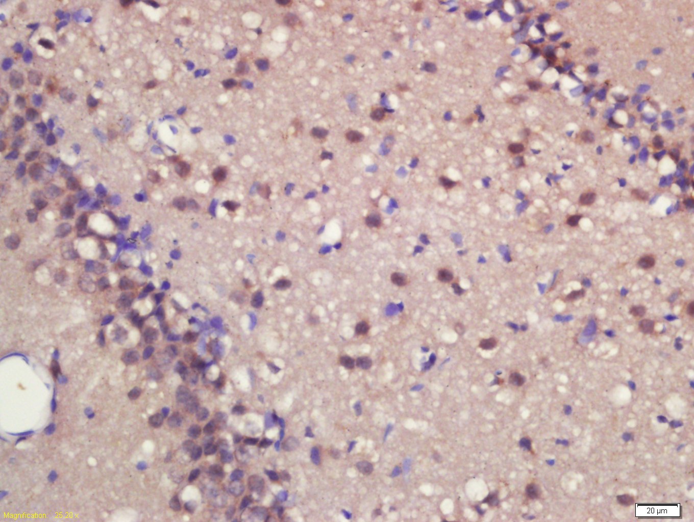 High Asf Rabbit ASCL1 Rabbit pAb (APR36309R)