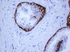 Cytokeratin 5 (KRT5) Mouse Monoclonal Antibody [Clone ID: LBI1F8]