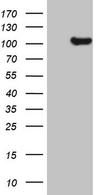 p90 Autoantigen (KIAA1524) Mouse Monoclonal Antibody [Clone ID: LBI4F5]